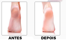 Esfoliador Removedor Elétrico para Calos e Rachaduras - ®Max Pedicure