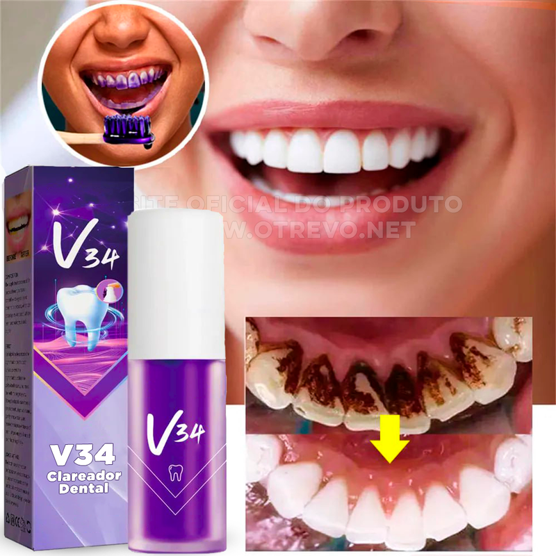 Clareador Dental - ®V34 (Clareamento instantâneo)